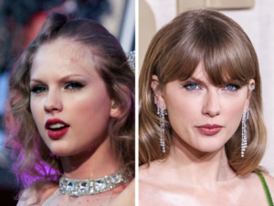14 Famous People Before and After Cheekbone Surgery