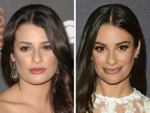 14 Famous People Before and After Cheekbone Surgery