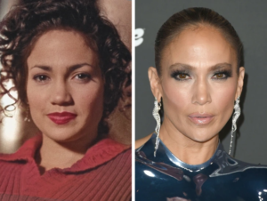 14 Famous People Before and After Cheekbone Surgery
