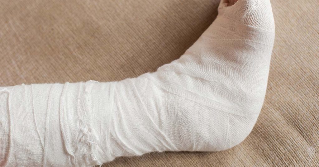 Teenager left hanging by broken leg on power line after car crash speaks out about moment she thought she was ‘done’ - Featured image