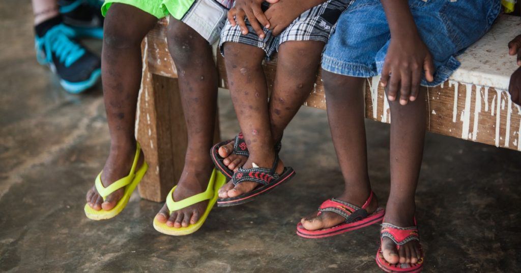 Wealthy Couple Abandoned Their Adopted Haitian Son in Jamaica After Discovering His Secret Habit - Featured image