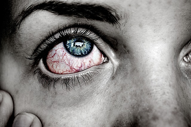 red painful eye