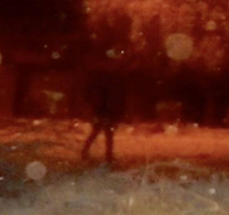 The 'Shadow Person' in the Backyard