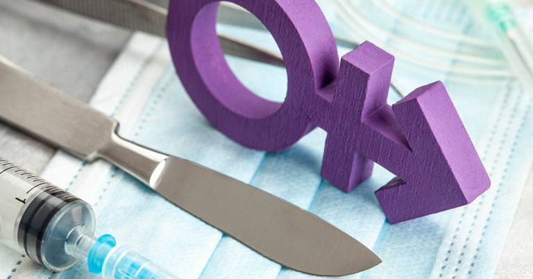 Jamie Wilson’s Powerful Before and After Transition Photos - Featured image