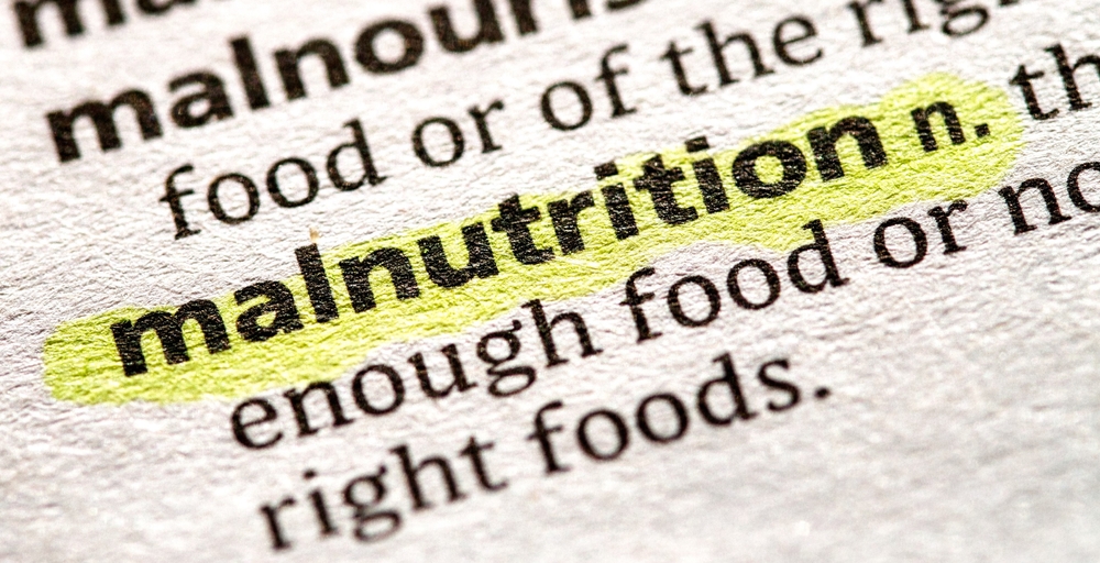 Close up photo of the word malnutrition in a dictionary book