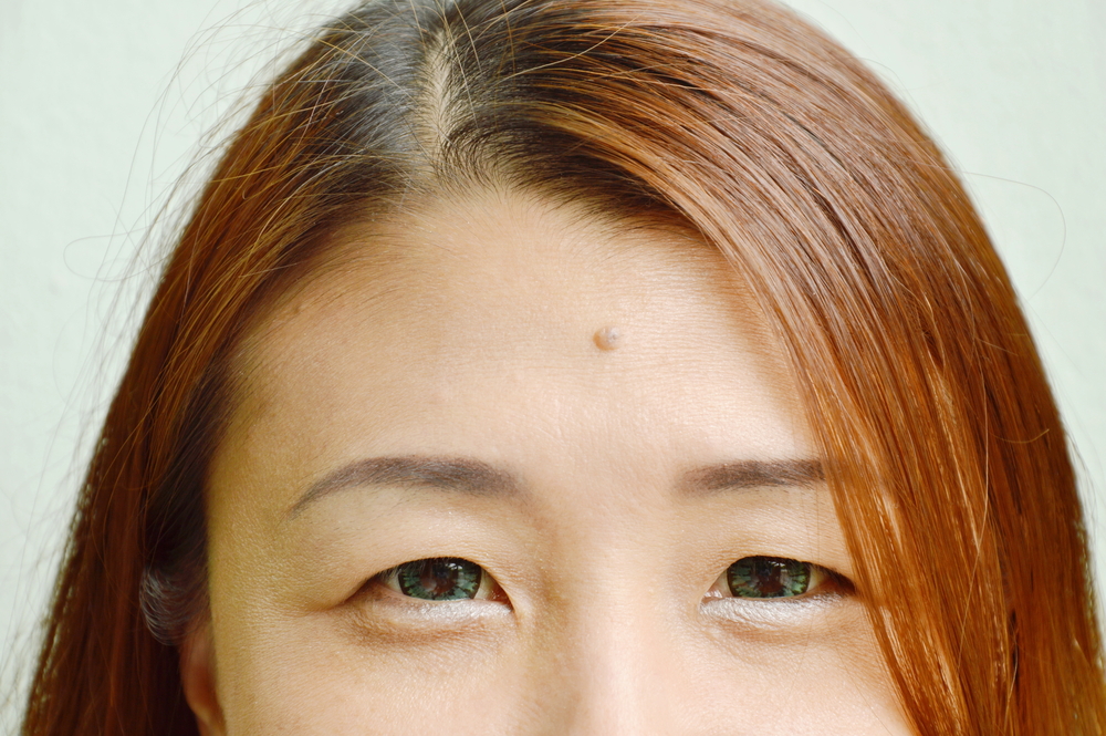 mole in middle of Asian woman forehead shows physiognomy