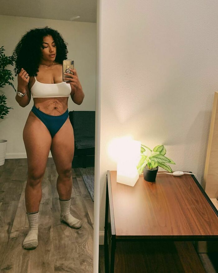 Postpartum bodies undergo incredible changes