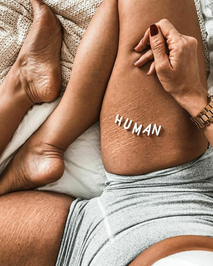 In a world obsessed with perfection, authenticity is a radical act.