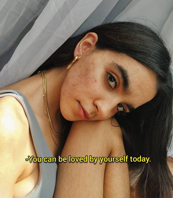 Body hair is a natural feature that has been unnecessarily criticized for decades.