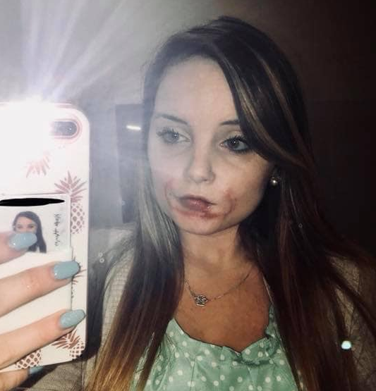 The journey to recovery for Kayla Hayes has been long and arduous