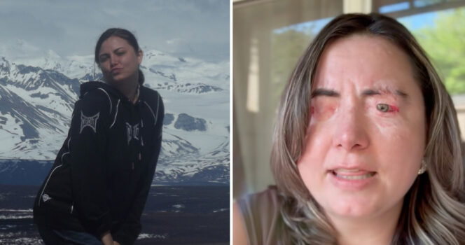 Side-by-side photos showing a Heather Cornelius journey: one against a mountainous backdrop and another showing visible facial injuries, illustrating the devastating physical trauma of domestic abuse survivors.