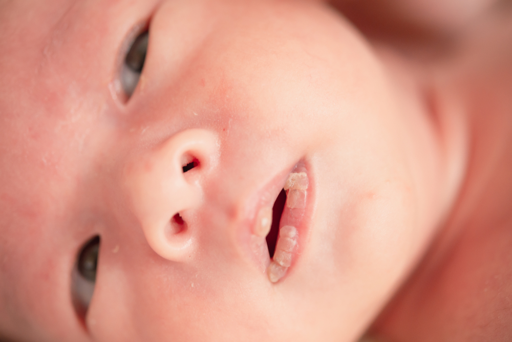 El bebé recién nacido tiene los labios secos y agrietados: boca agrietada, áspera y seca, erostomía