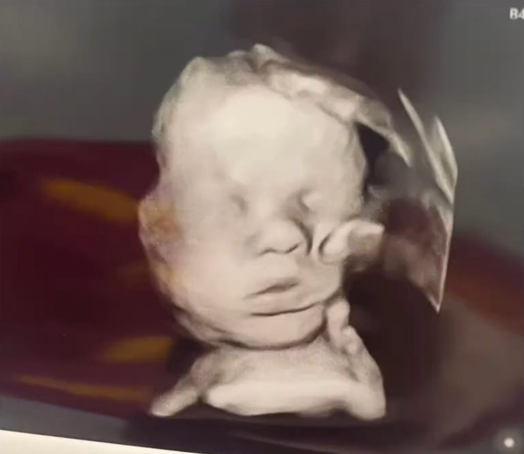 larger image of ultrasound