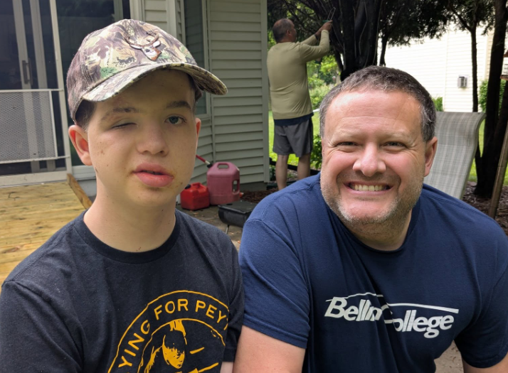 Doctors initially had little hope Brett would survive the power washer accident
