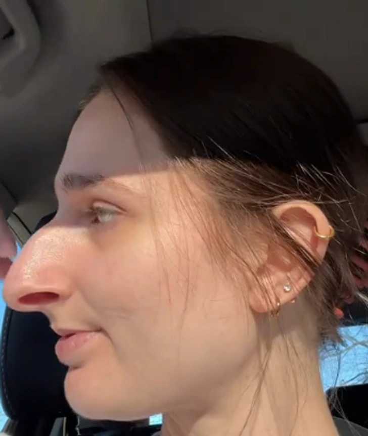 Aiken’s journey to her nose job surgery took over a decade.