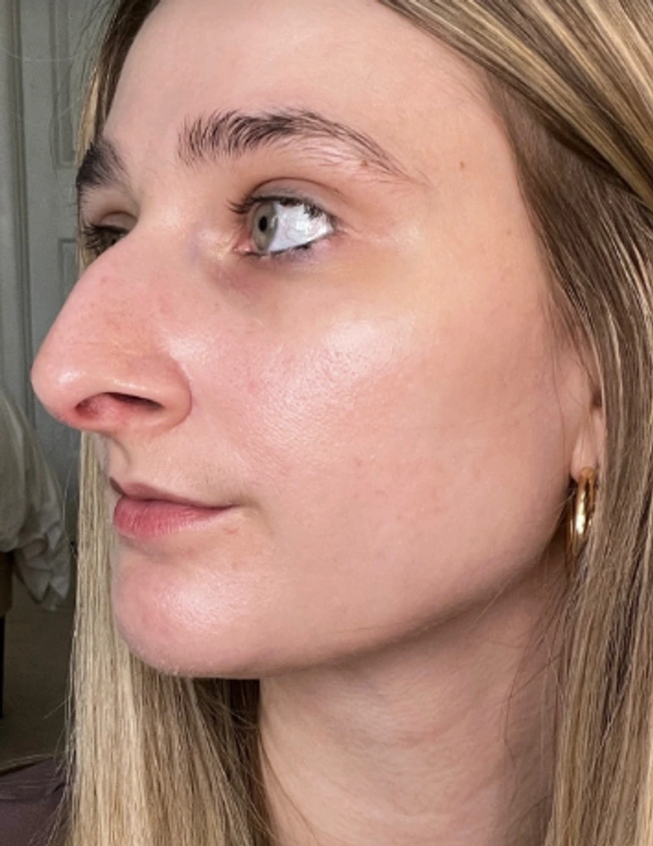 Aiken did not tell her family until one week before the nose job surgery.