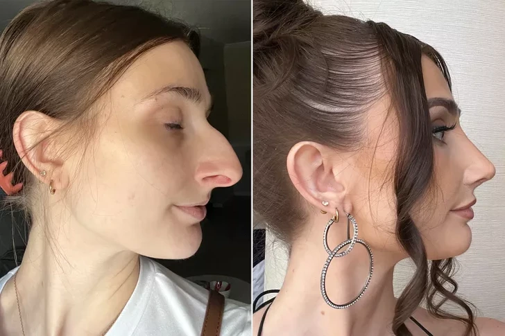 Aiken’s social media has become a safe space for others contemplating plastic surgery.