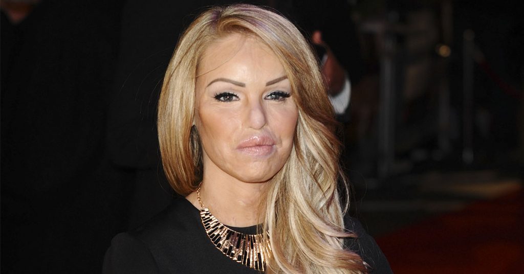 “I’ve Reached the End of the Road”: Katie Piper Opens Up After 16 Years - Featured image