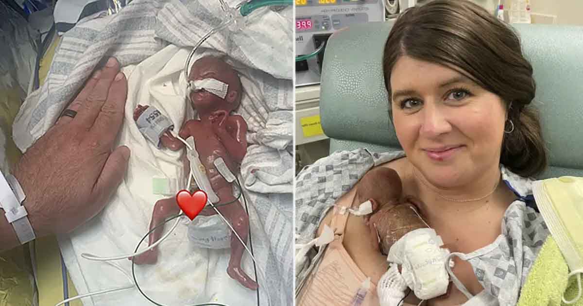 Guinness World Records Names Iowa Baby ‘Most Premature’ at Just 21 Weeks