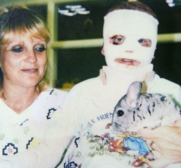 Terry’s earliest years were marked by relentless medical treatment.