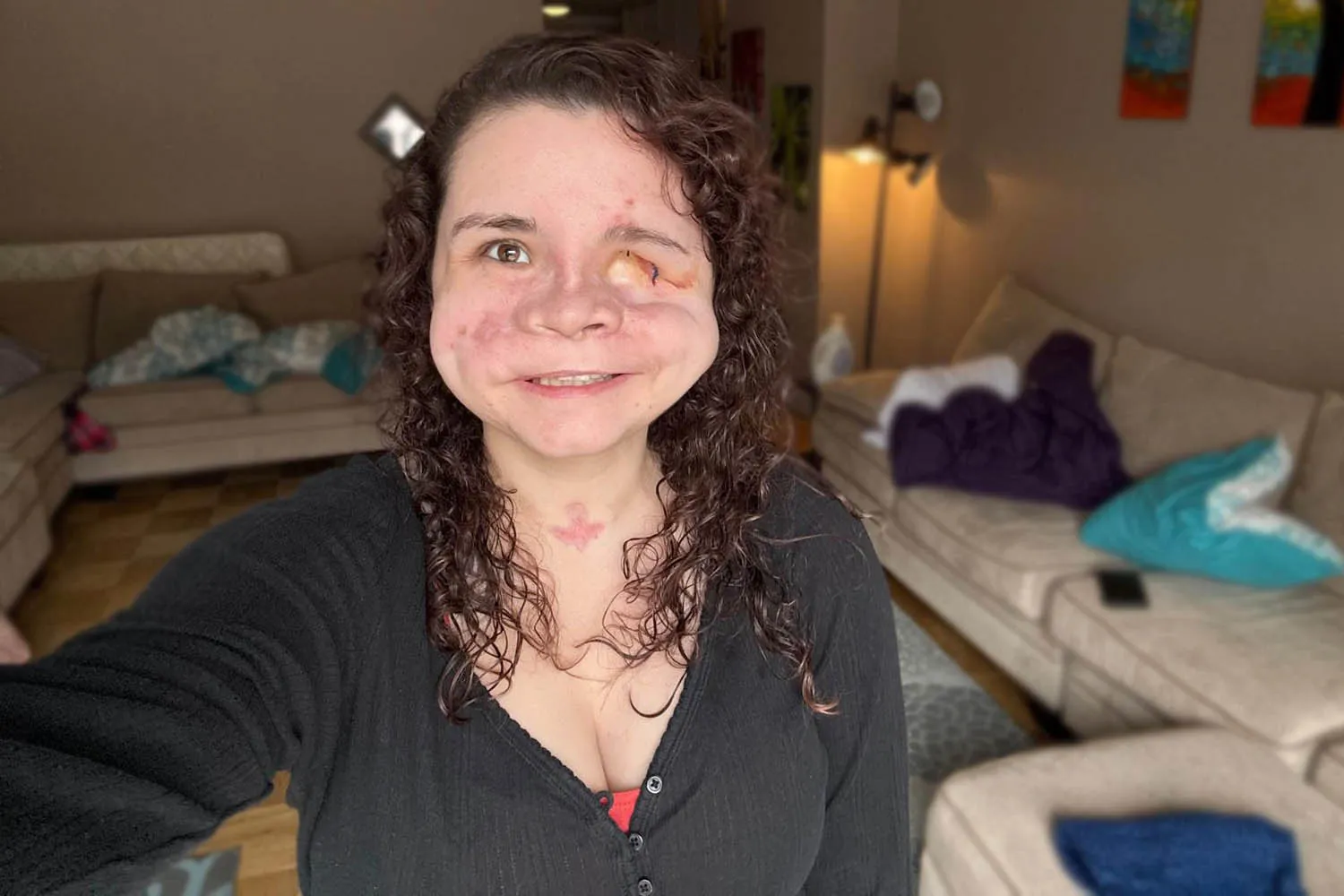 Amedy Dewey taking a recent selfy showing what she looks like after being shot in the face by her Stepfather