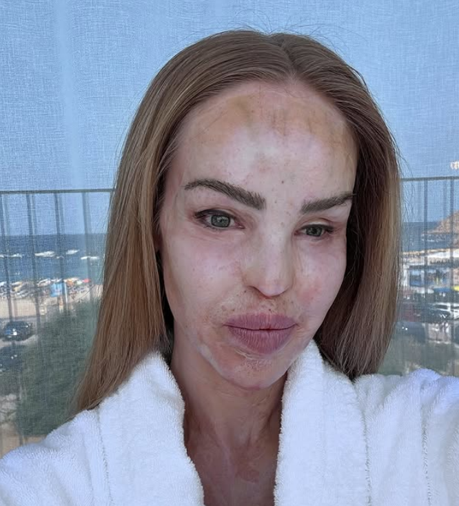 In January 2025, Katie Piper posted a candid announcement on social media