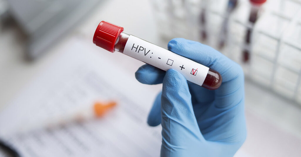 The Link Between Oral Sex and Throat Cancer: Michael Douglas’ Personal Story - Featured image