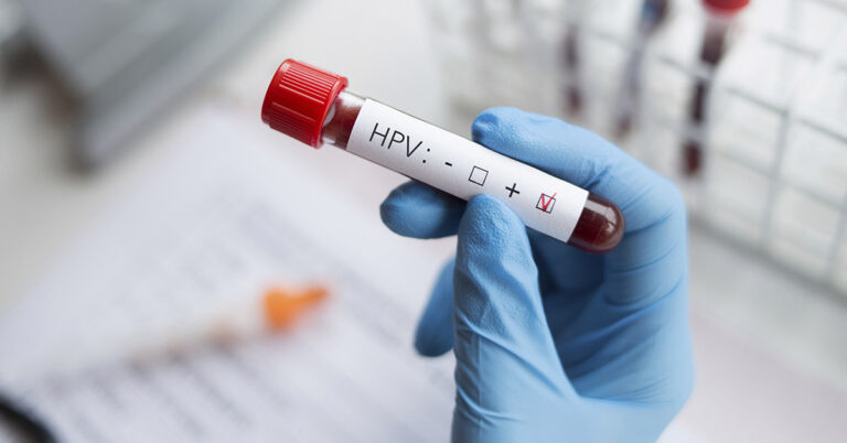 The Link Between Oral Sex and Throat Cancer: Michael Douglas’ Personal Story - Featured image