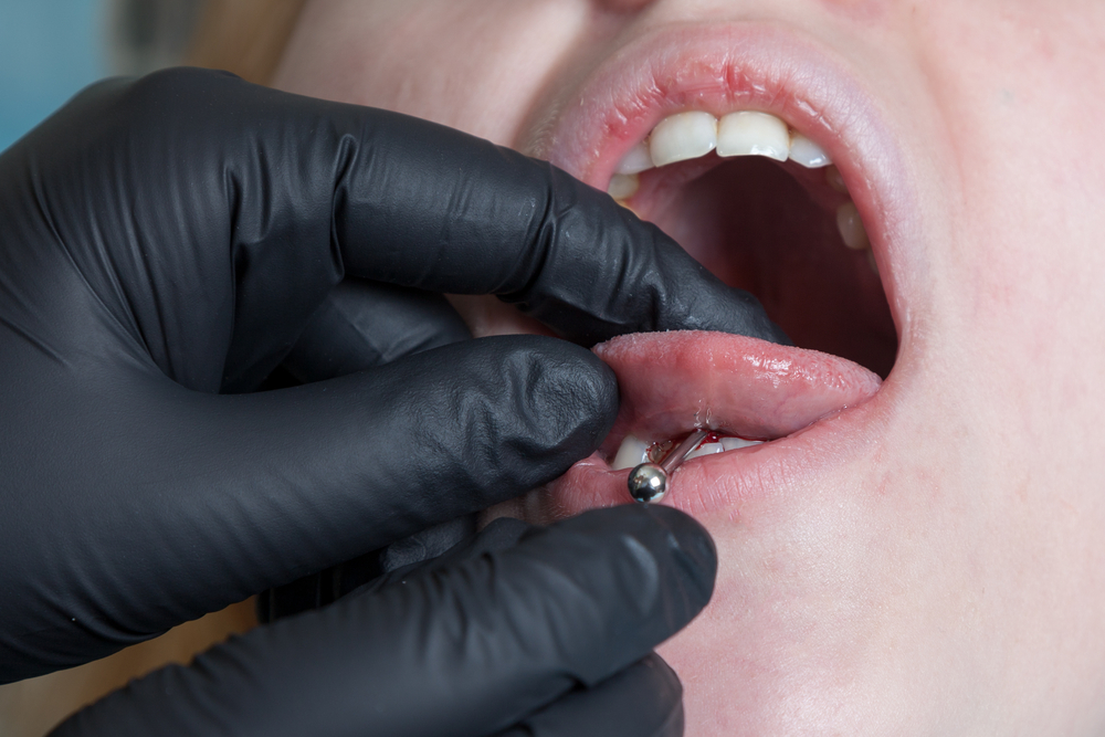 Tongue piercing operation