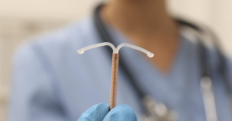 The Baby Who Beat Birth Control — and Brought His Mom’s IUD With Him - Featured image