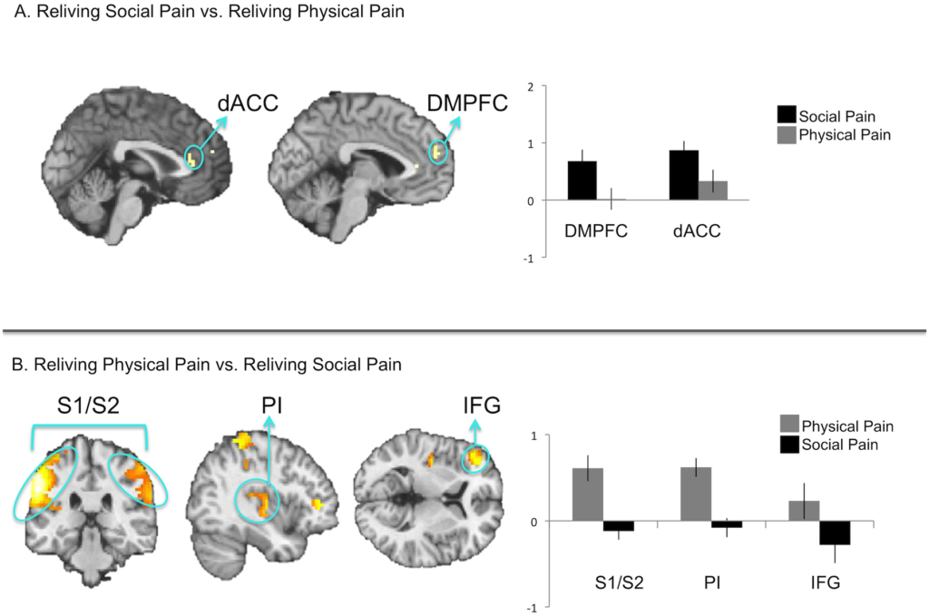 Brain scan figure comparing social versus physical pain recall, showing the dACC and DMPFC activate more for social pain while the S1/S2, posterior insula, and inferior frontal gyrus respond more strongly to physical pain memories.