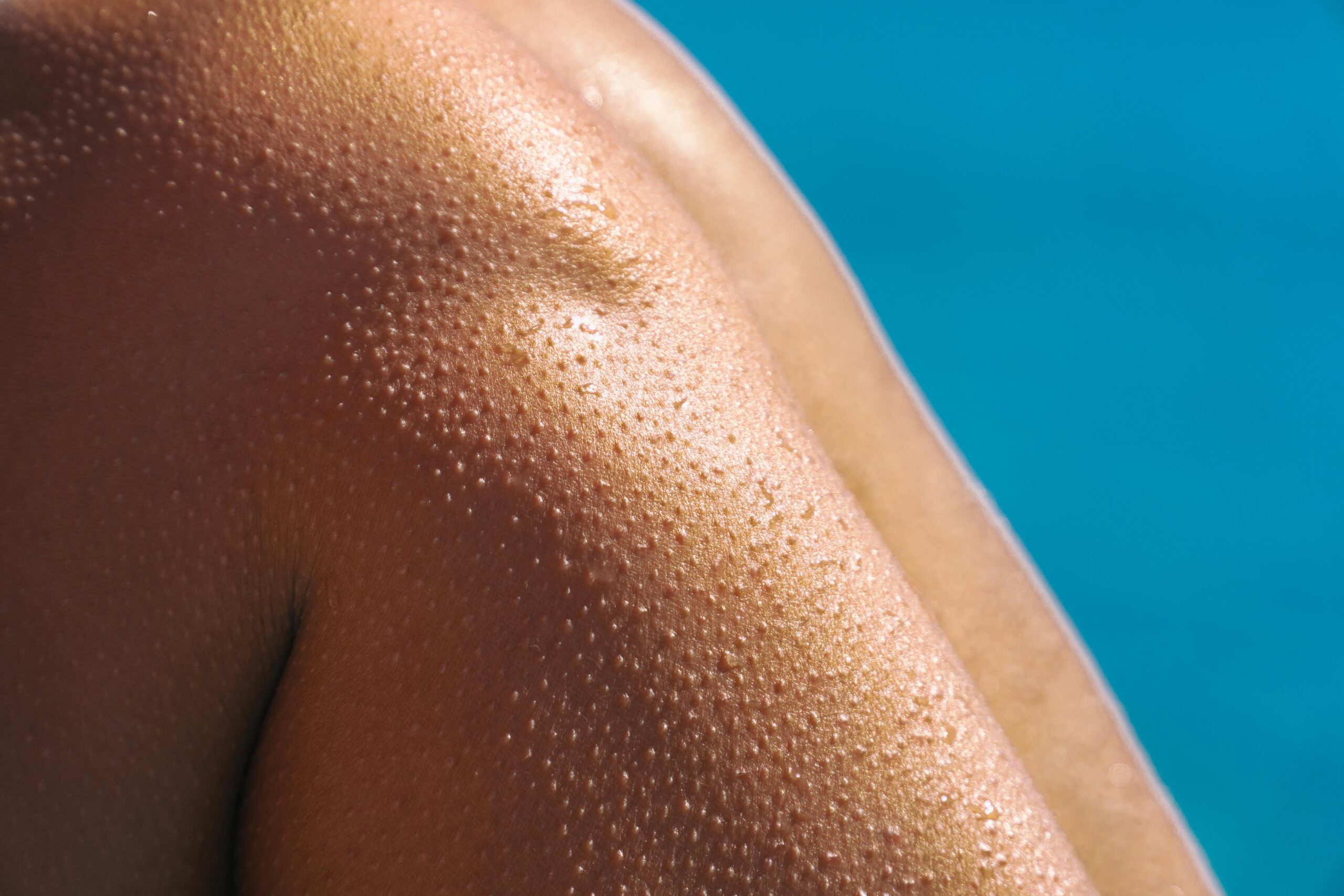 Close-up of a shoulder and upper arm glistening with water droplets, skin showing goosebumps. A bright blue background suggests a pool setting.