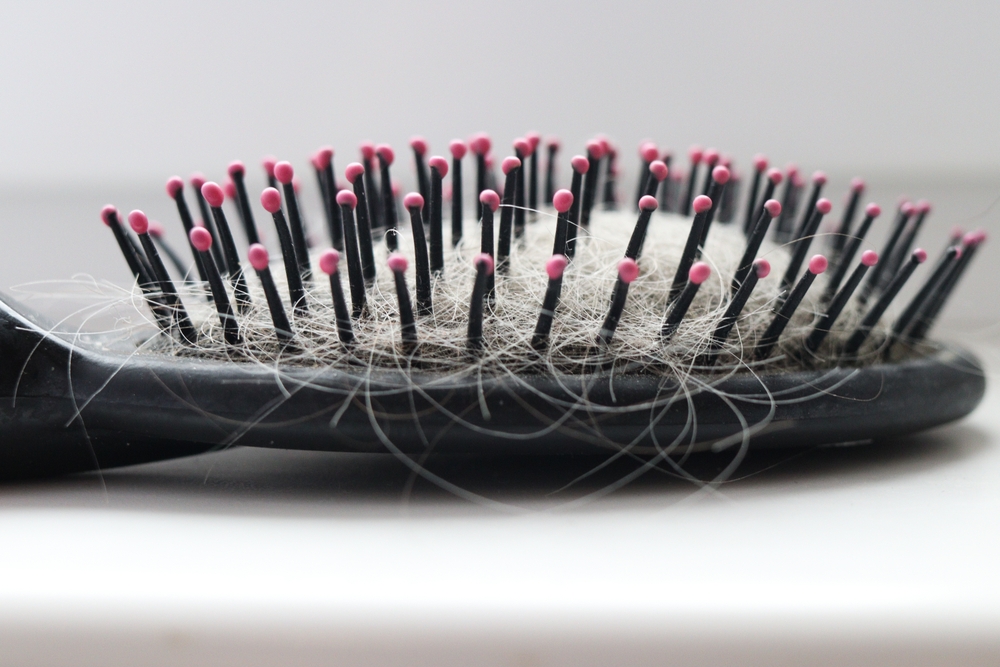 black plastic comb with pink tips on the teeth, tangled in fallen hair. hair indicates the need to clean the comb.a reminder of the importance of hair care and monitoring to prevent excessive shedding