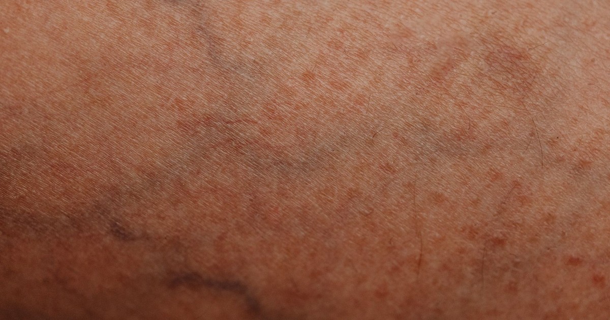 Detailed close-up of human skin with visible texture and veins, showcasing natural patterns.