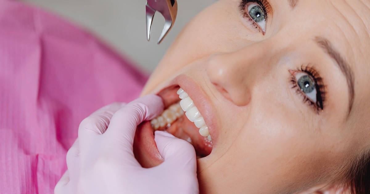 A dentist performing a tooth extraction on a patient in a dental clinic.