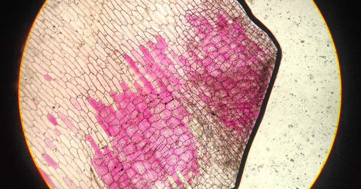 Close-up of stained plant cells in onion root under microscope.