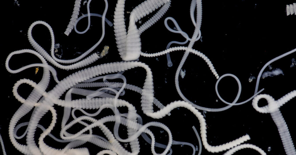 Doctors Thought He Had Brain Cancer. It Was Tapeworm Infection Instead. - Featured image