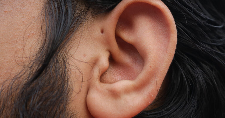 Tiny Hole Above Your Ear? Here’s What an Ear Pit Really Means - Featured image