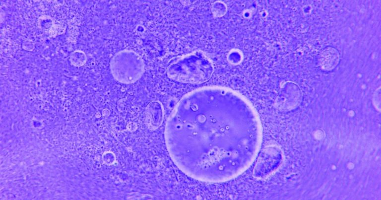 The Surging Virus That Erases Years of Immunity, According to Health Experts - Featured image