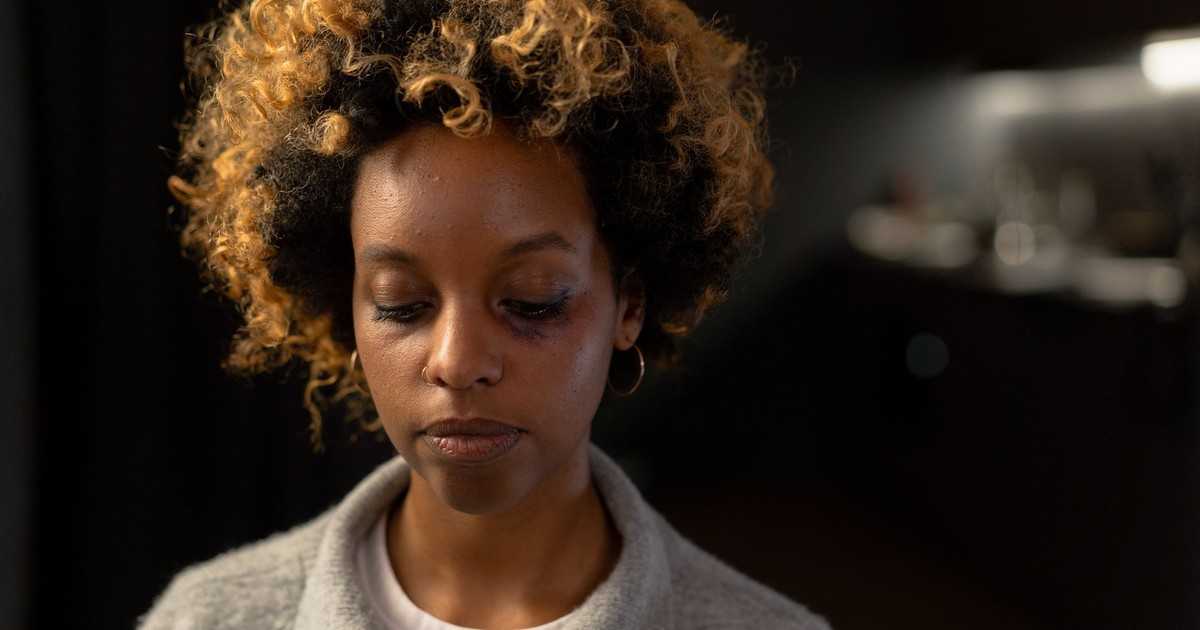 A woman with a bruise on her face, looking thoughtful in an indoor setting.