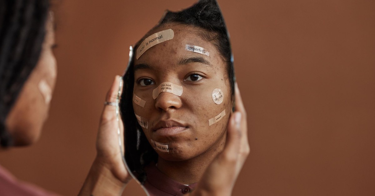 African American woman with Band-Aids looks into a shattered mirror, reflecting self-acceptance.